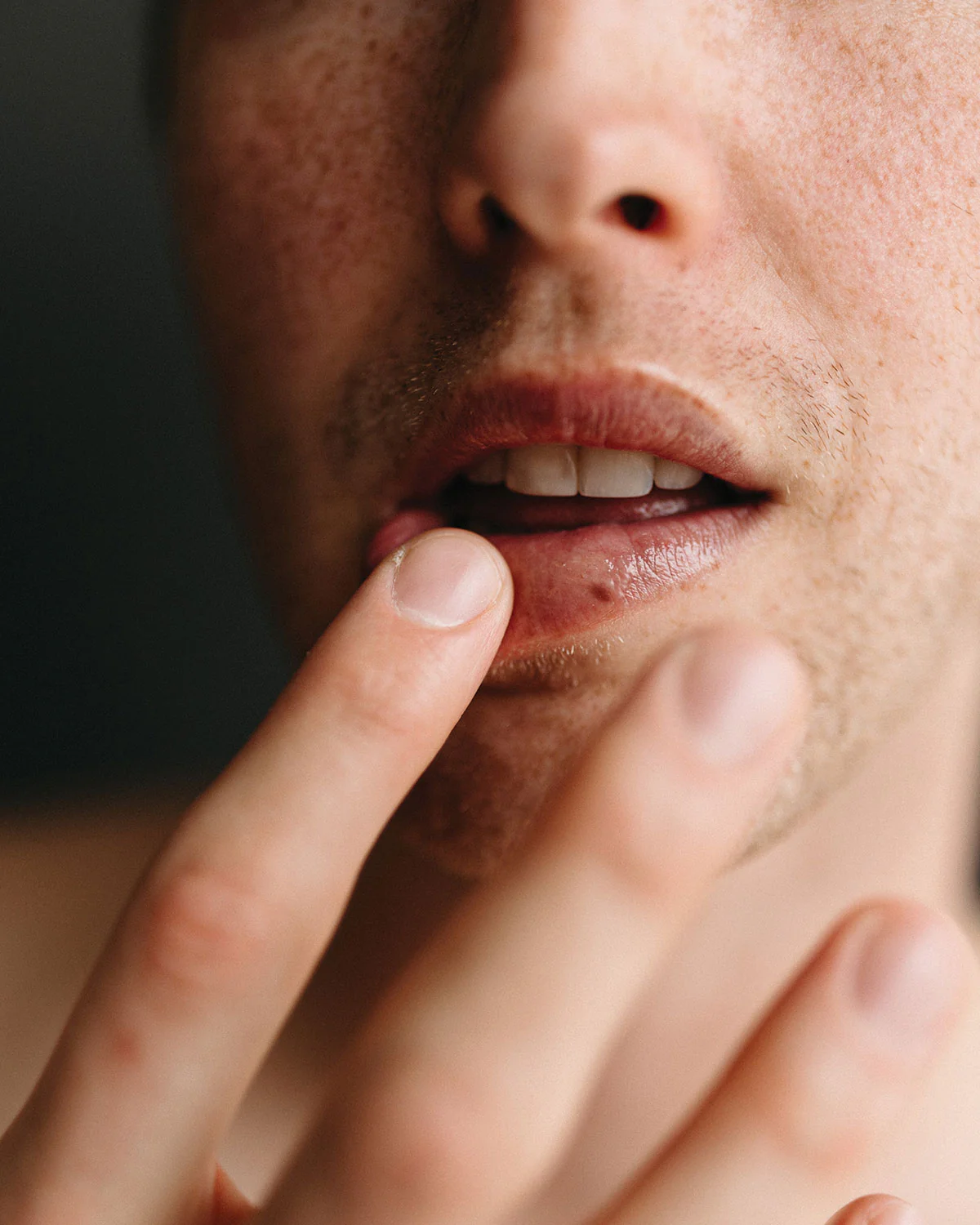 Formula F06 - The Lip Fix - Image 4